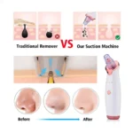 Rechargeable Blackhead Remover Nose onemall.lk