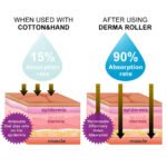 Derma Face Roller Medical Dermaroller Beauty Skincare onemall (5) - Onemall.lk